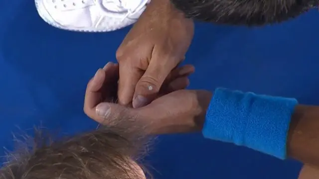 Djokovic's thumb