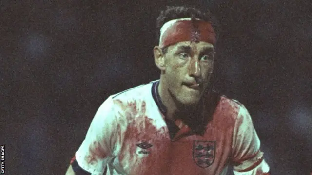 Terry Butcher