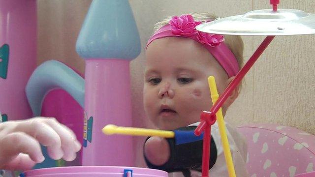 Harmonie-Rose, who lost part of her limbs and face from meningitis, playing with a drum kit