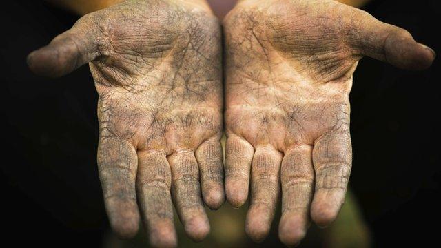 dirty hands