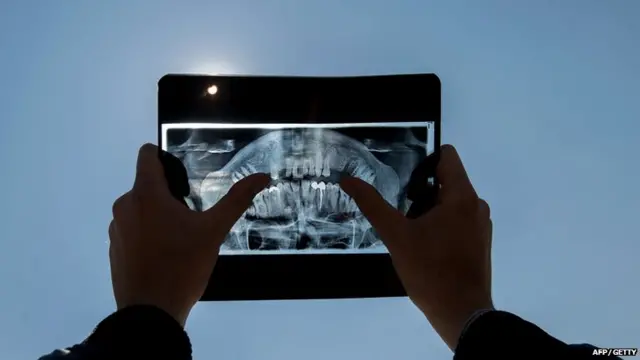 A man uses a dental X-ray to watch a partial solar eclipse in Pristina