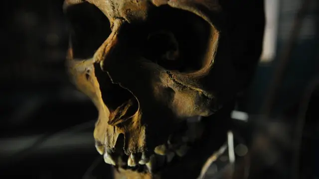 Mary Rose skull