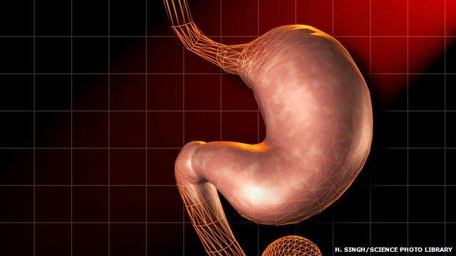 Stomach cancer can be detected late