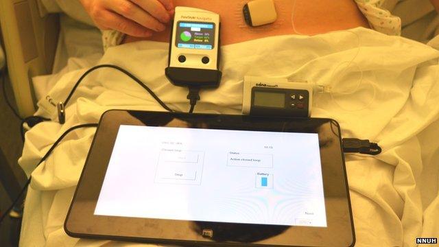 The artificial pancreas attached to a computer tablet