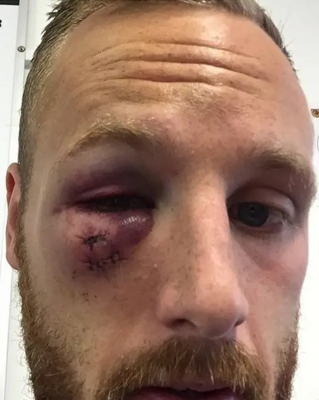Meyler
