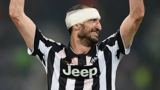 Chiellini