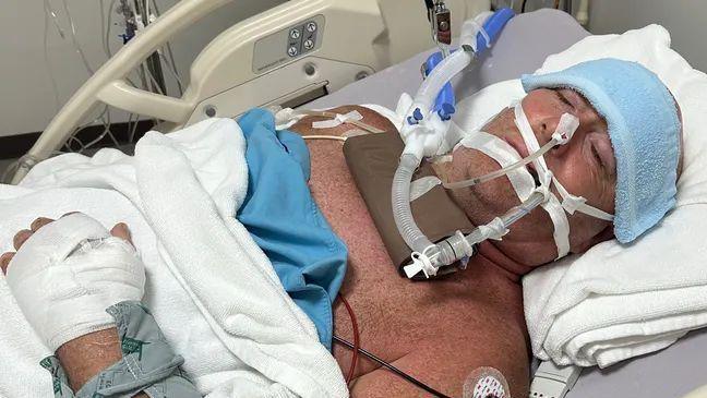 Lee Francis  is pictured on a ventilator in a hospital bed in Thailand