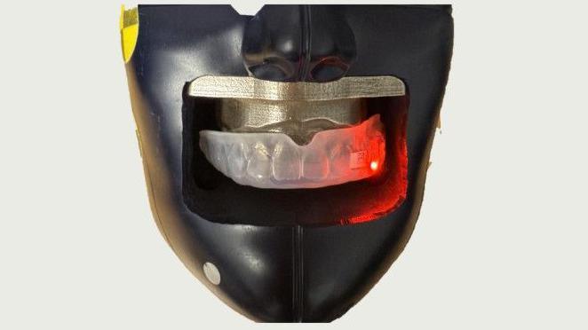 An instrumented mouthguard