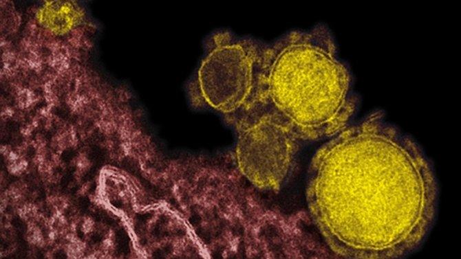 Mers particles