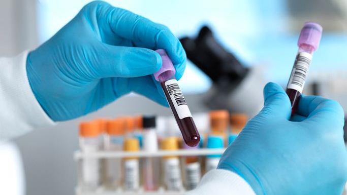 A pair of hands with blue gloves on. The hands are holding vials with dark red liquid in them. In the background there are a dozen or so vials.
