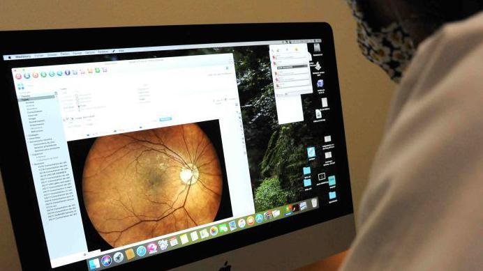 An health work looks at a computer screen showing an image of a patients fundus.