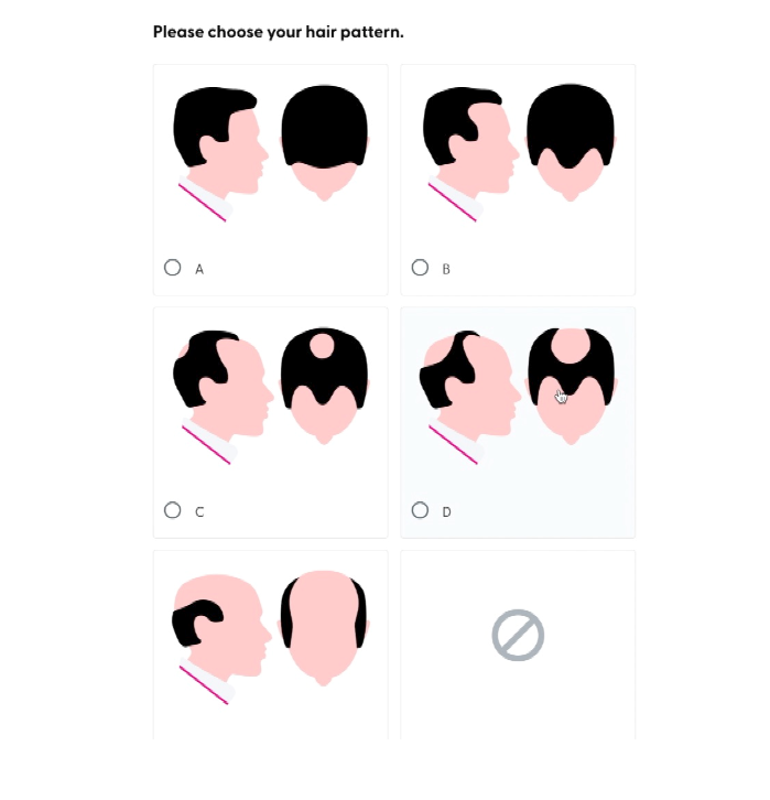 Diagrams showing examples of male pattern hair loss that one of the online pharmacies asks customers to consider