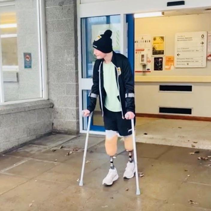 Teenage boy with two prosthetic legs below his knee walking out of hospital on a pair of crutches.