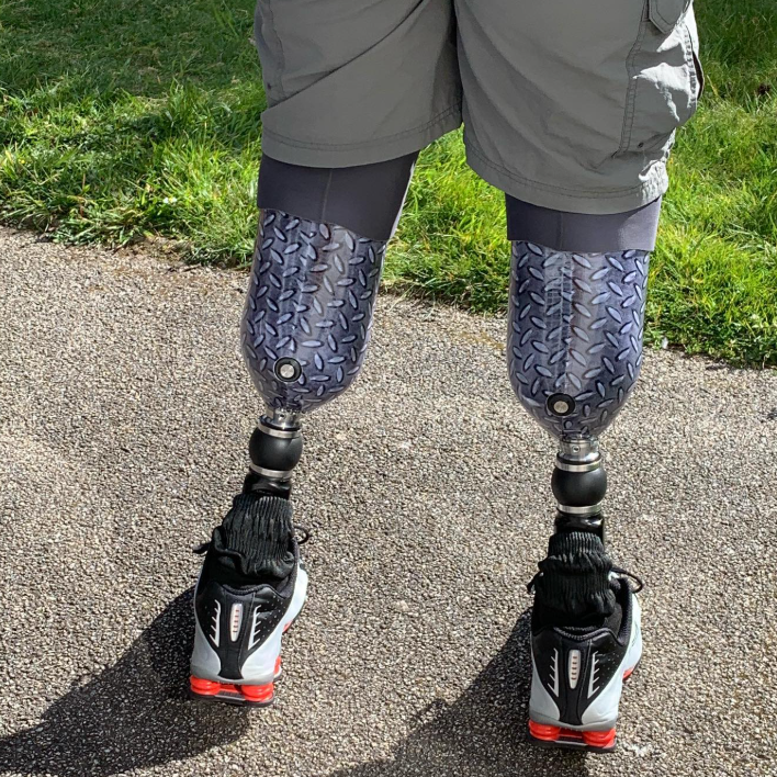 A shot of Neil Hopper's prosthetic legs shot from behind. They have a blue and grey pattern and he is wearing black and white trainers.