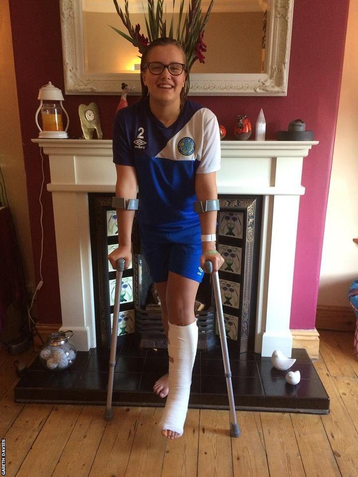 Holly broke her ankle after tripping at home while playing with her sister