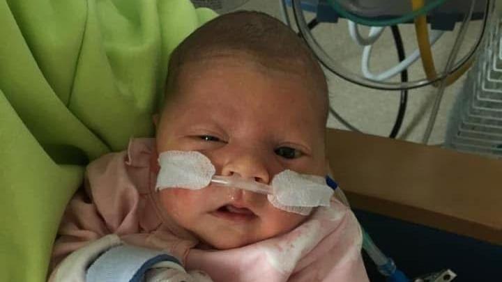 Brie as a young baby in hospital - she has a tube in her nose