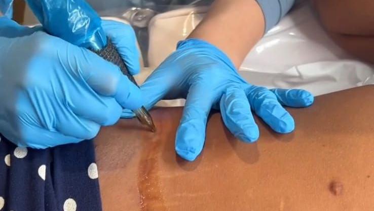 close-up showing Darcie's hands in blue surgical gloves drawing a medical tattoo over a client's scar 