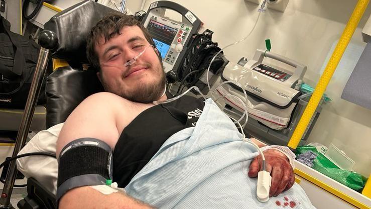 William, with dark hair and a beard, lies in an ambulance. He is covered by a blanket and has wires from machines connected to his body. His hand is covered in blood. He is smiling towards the camera.