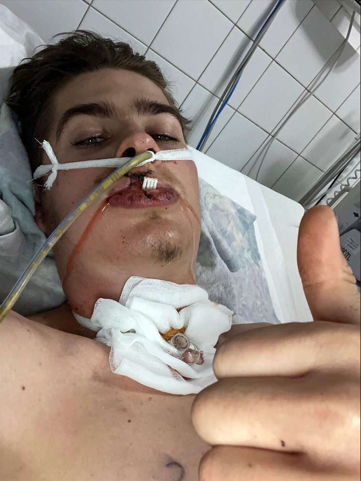 Ivan wounded in hospital