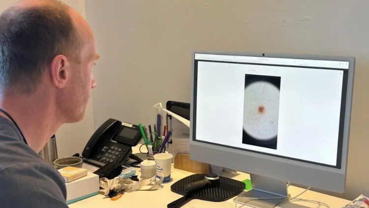 Dr Toby Nelson, seen from the side, looking at a computer screen with a picture of a mole. 