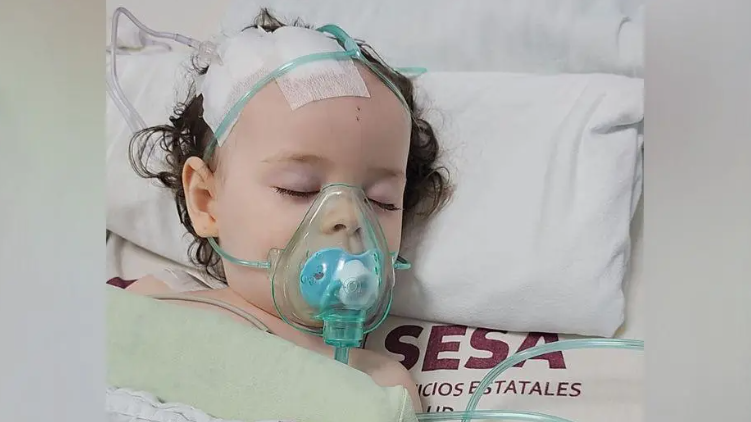 Sienna-Rose is photographed lying in a hospital bed with a plastic mask covering her nose and mouth. There are bandages on the head of the little girl, who has dark brown, curly hair.