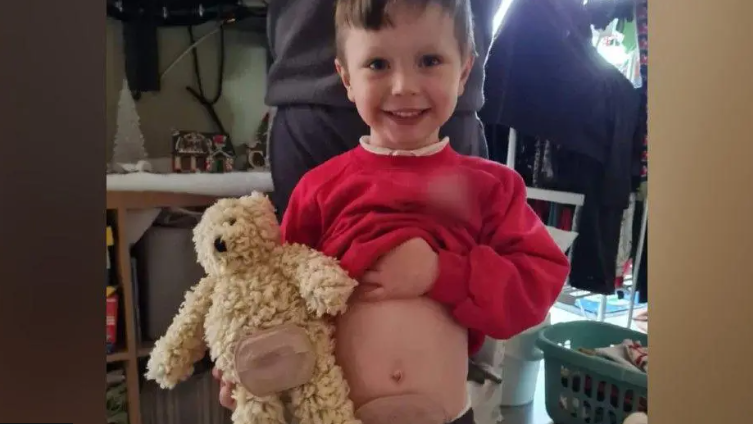 A young boy lifts his jumper to show his stoma. He carries a teddy which also has had a stoma put on it. Riley, aged 6, is wearing a red jumper and smiling at the camera.