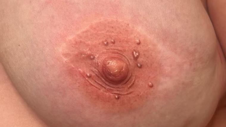 A view of a nipple tattoo created by Kirsty Jackson. 