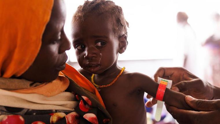 Children are give a MUAC, (mid-upper arm circumference) test, to screen for signs of malnutrition inside the Médecins Sans Frontières, (MSF) clinic at the refugee transit camp on April 25, 2024 in Adre, Chad.