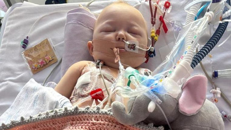 Melody lies asleep in a hospital cot beside a toy elephant. The bed is covered in medical tubing, which enters her nose and mouth.