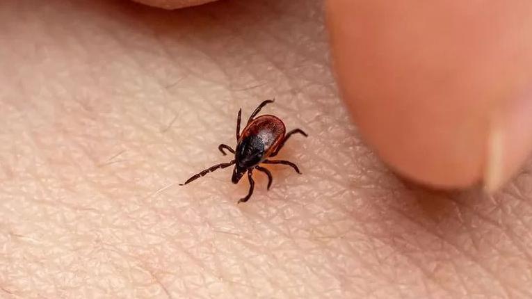 Tick on skin