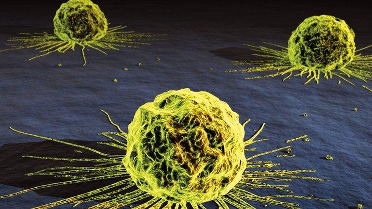 Cervical cancer cells