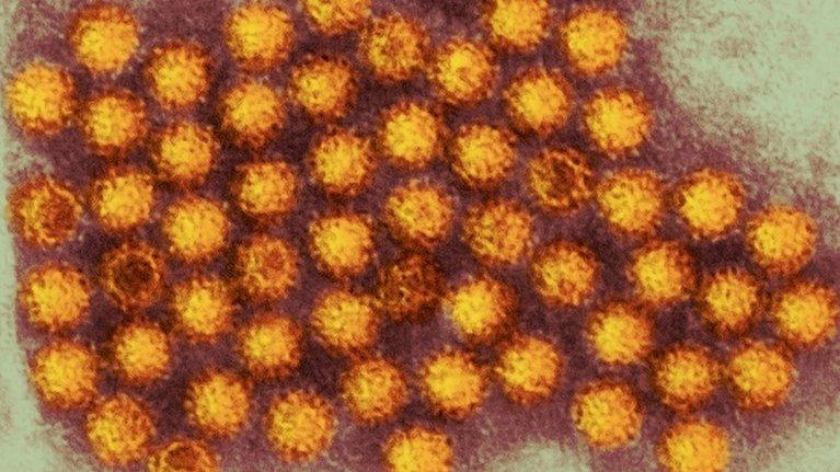 Norovirus