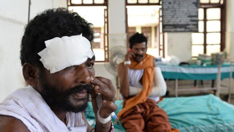 Injured Indian patients recuperate after their admission to The Kollam District Hospital near Paravur on April 11, 2016,following a huge fire at the Puttingal Devi Temple in the southern Indian state of Kerala.