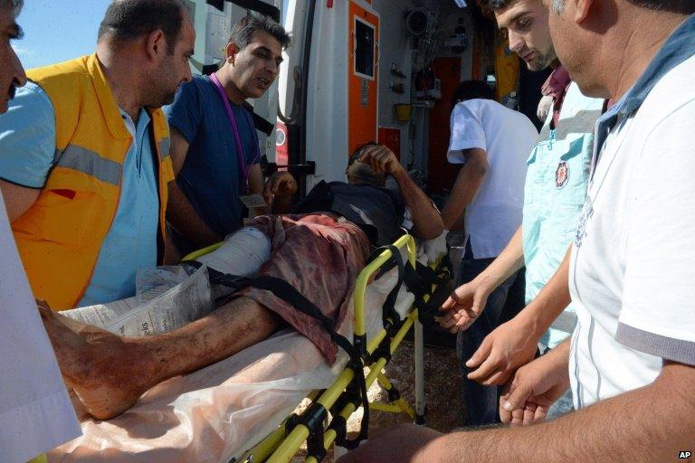Turkish medics carry a wounded person arrived from the Syrian town of Ayn al-Arab or Kobani following the attacks by IS militants, on the Turkish side of the border in Suruc, Turkey, on 25 June 2015