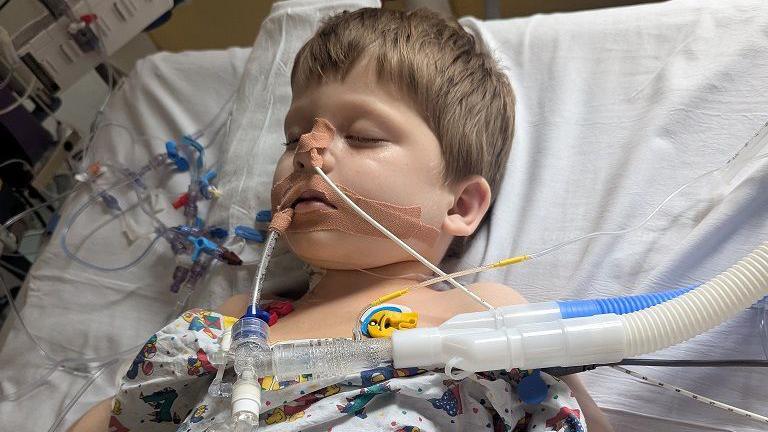 a small boy lying asleep in a hospital bed, with breathing tubes attached to him with surgical tape. His hospital gown is designed with cartoon characters.