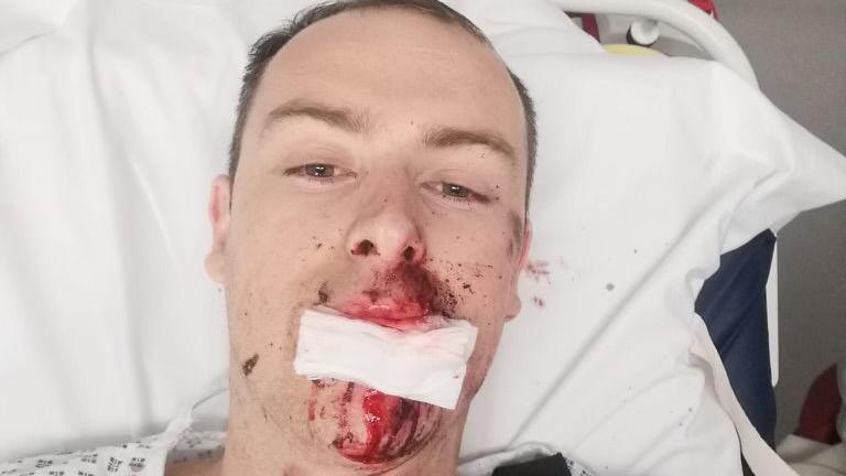 Josh Paul in a hospital bed, with blood on his hospital gown and a bandage over his mouth