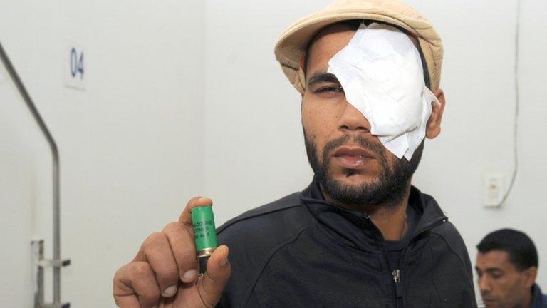 A Tunisian man shows a cartridge after he was injured during clashes with police in the town of Siliana on 28 November 2012