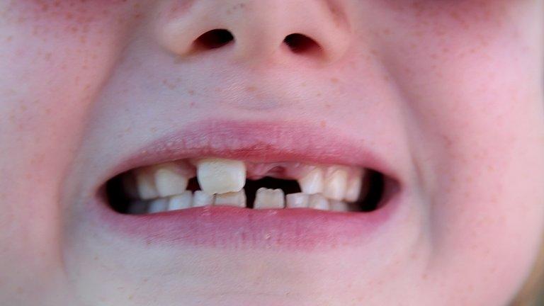 Child's teeth