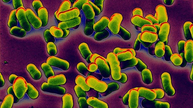 Clusters of the bacteria that cause bubonic plague