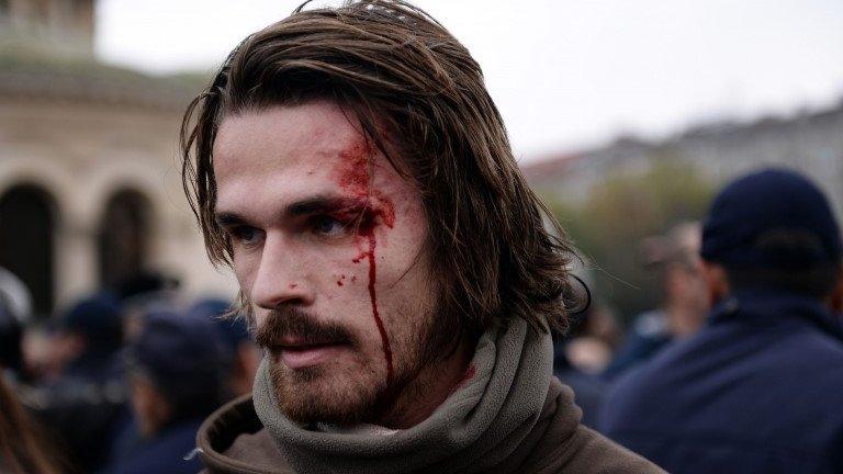 Injured protester in Sofia, 12 November (photo by Anna Stambolieva)