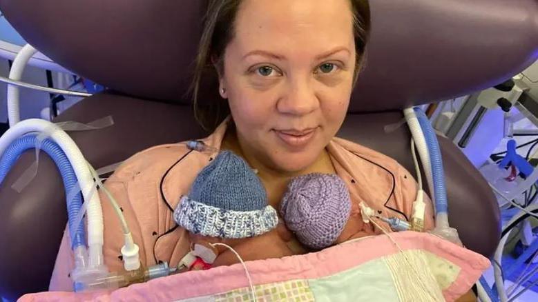Jade in a purple chair with two tiny babies on her chest. They have several tubes attached to them. 