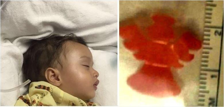 Laith under general anaesthetic and the plastic toy found in his throat