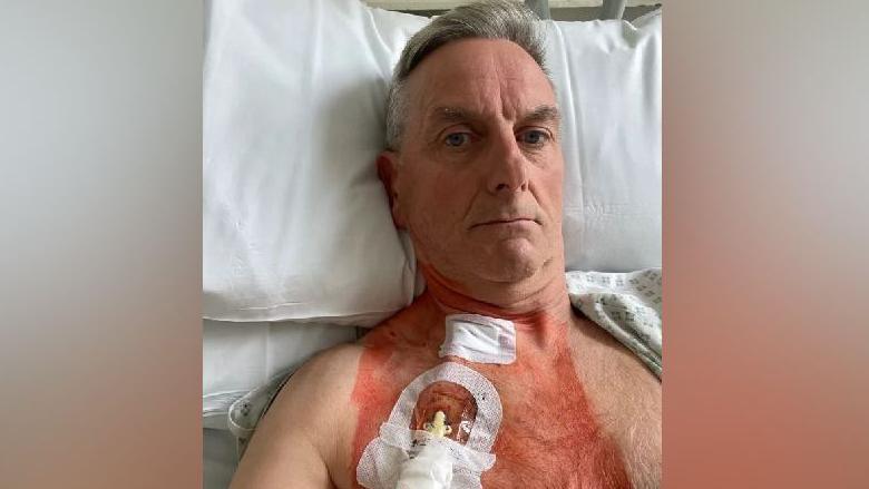 Tim Blackburn undergoing dialysis. He is in a hospital bed and has a tube inserted into his chest. He has short grey hair and no facial hair. He is looking at the camera with a slight frown.