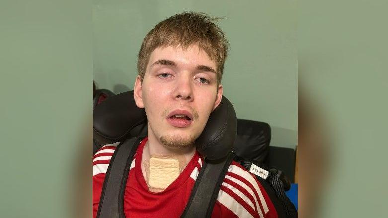 George Rabbett, wearing a chest harness and red t-shirt, looks into the camera. There is a large plaster on his throat.