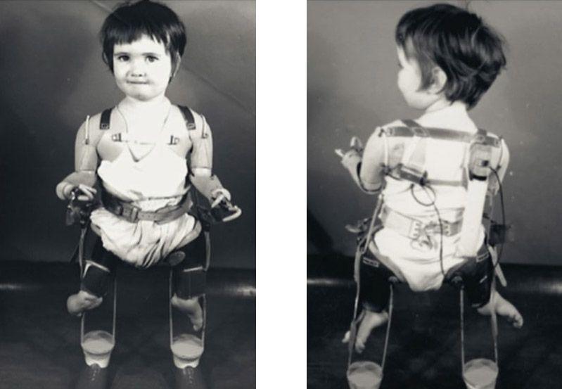 A black and white image of Alison Lapper as a small child wearing artificial legs. There are two pictures, side by side. One is of Alison facing the front and the other, facing the back.