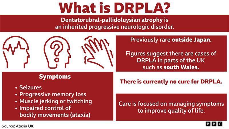 A graphic highlighting DRPLA and the symptoms associated with the condition. The headline says What is DRPLA? Underneath it syas Dentatorubral-pallidoluysian atrophy is an inherited progressive neurological disorder. Under that the sub-head reads Symptoms and bullet pointed are four symptoms which read: Seizures, progressive memory loss, muscle jerking or twitching and impaired control of bodily movements (ataxia). To the right of this it says Previously rare outside Japan, and under this reads Figures suggest there are cases of DRPLA in parts of the UK such as south Wales. Under this it says There is currently no cure for DRPLA. And the final line in the graphic reads Care is focused on managing symptoms to improve quality of life.