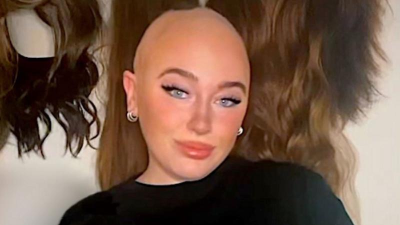 Olivia McVeigh: 'It's an honour to represent women with alopecia' - BBC ...