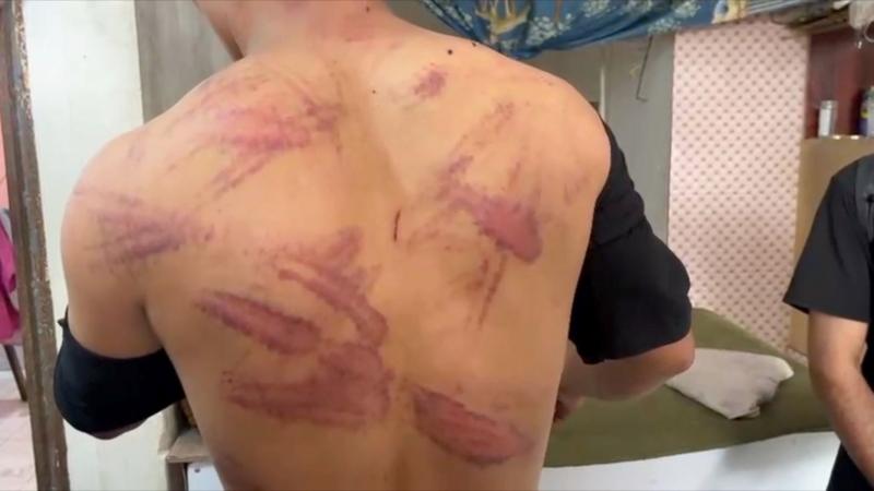 Iran drives out 1.5 million Afghans, with some branded spies for Israel