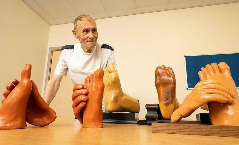 Robert Harness with wooden hands and feet he has made 