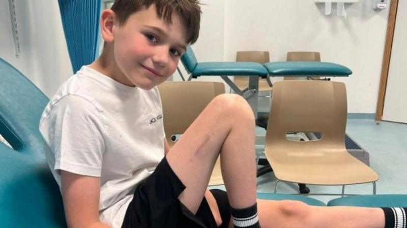 Boy becomes first in UK to have surgery to make him taller